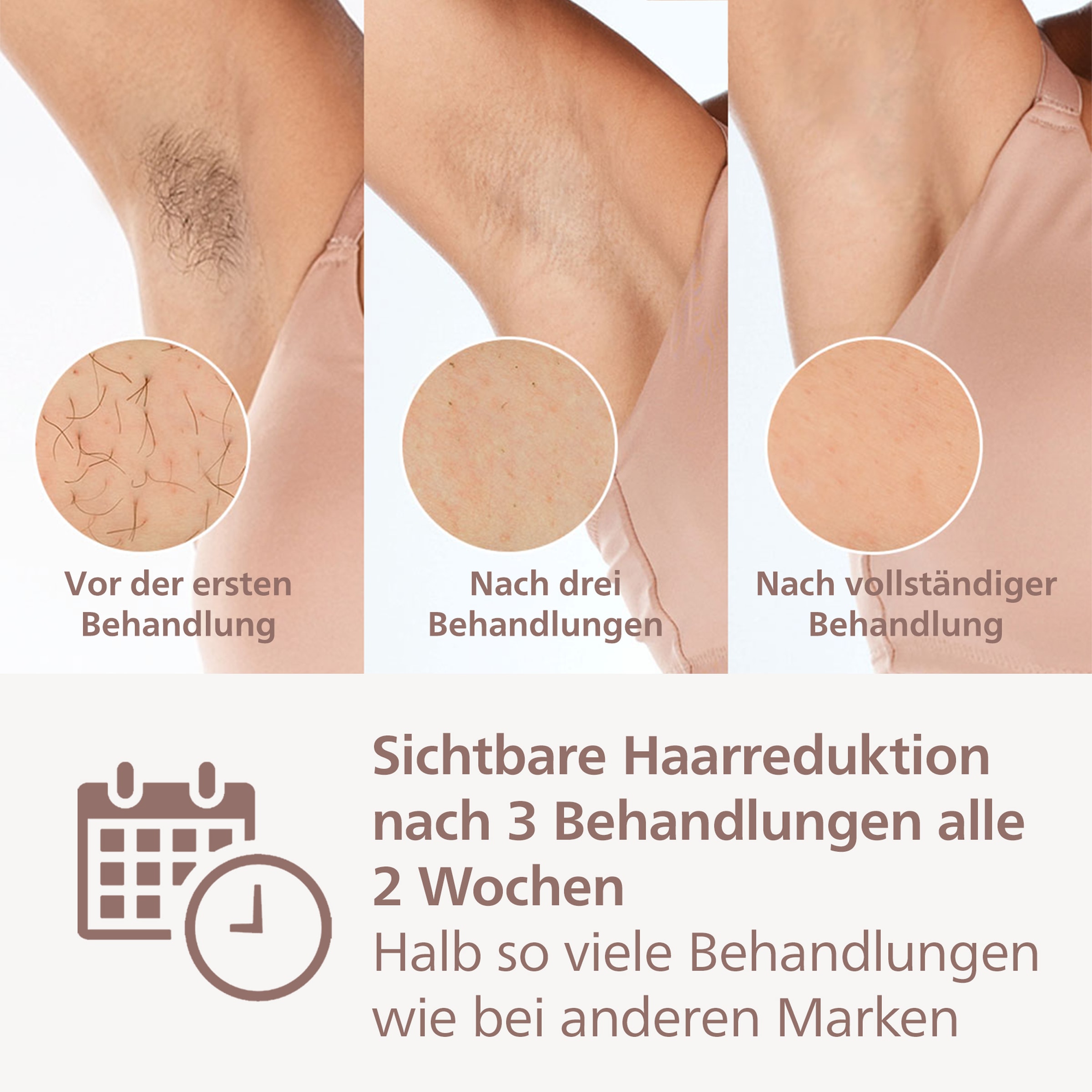 Philips Épilateur IPL »Lumea S9000 BRI955/00« 450.000 Lichtimpulse 3 Aufsätze (Körper, Gesicht und Präzisionsaufsatz), kabellos