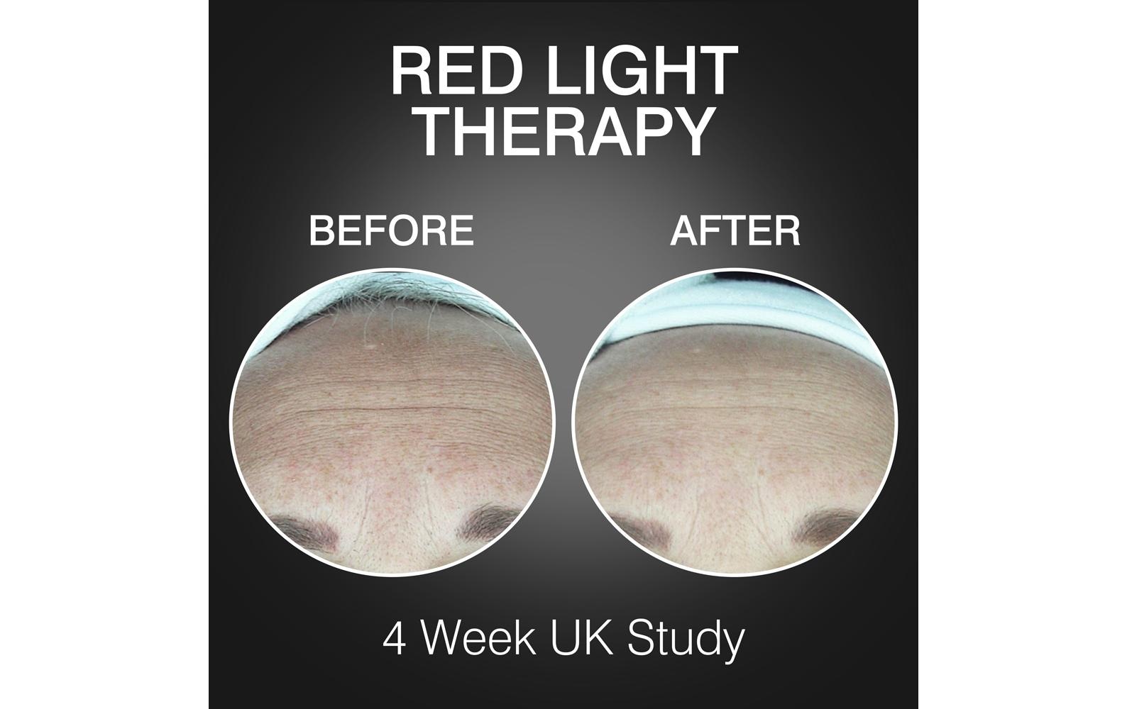 Rio Lichttherapiegerät »FaceGLO 1072 mit Serum«