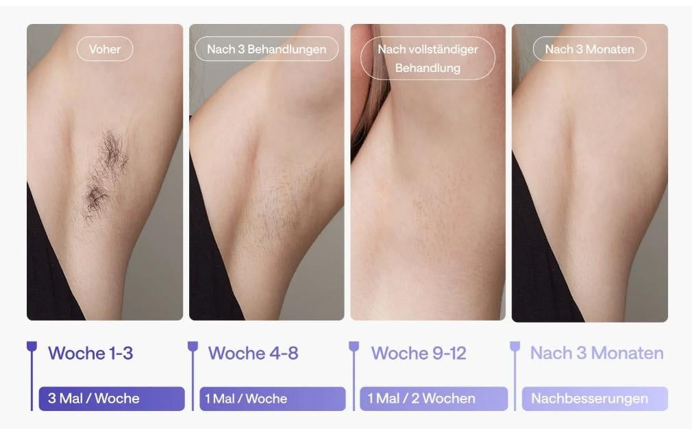   Épilateur IPL »Ulike Air 3«