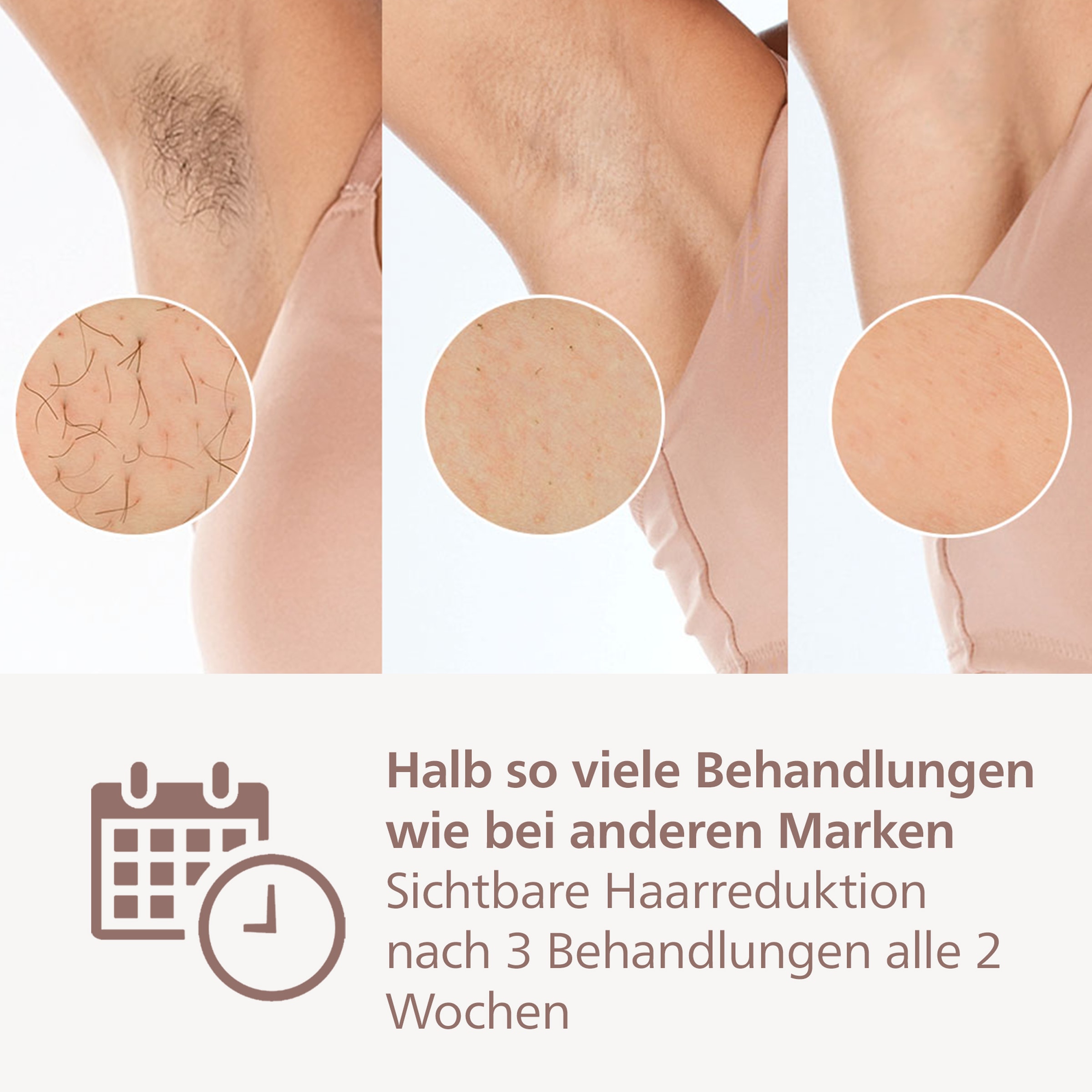 Philips IPL-Haarentferner »Lumea Series 9900 BRP959/00«, 450 000 Lichtimpulse, 4 Aufsätze (Achseln, Bikinizone, Körper, Gesicht), 2 SkinAI Funktionen