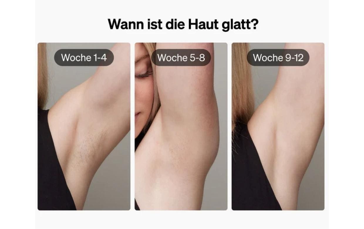 IPL-Haarentferner »Ulike Air 3«, 1000000 Lichtimpulse