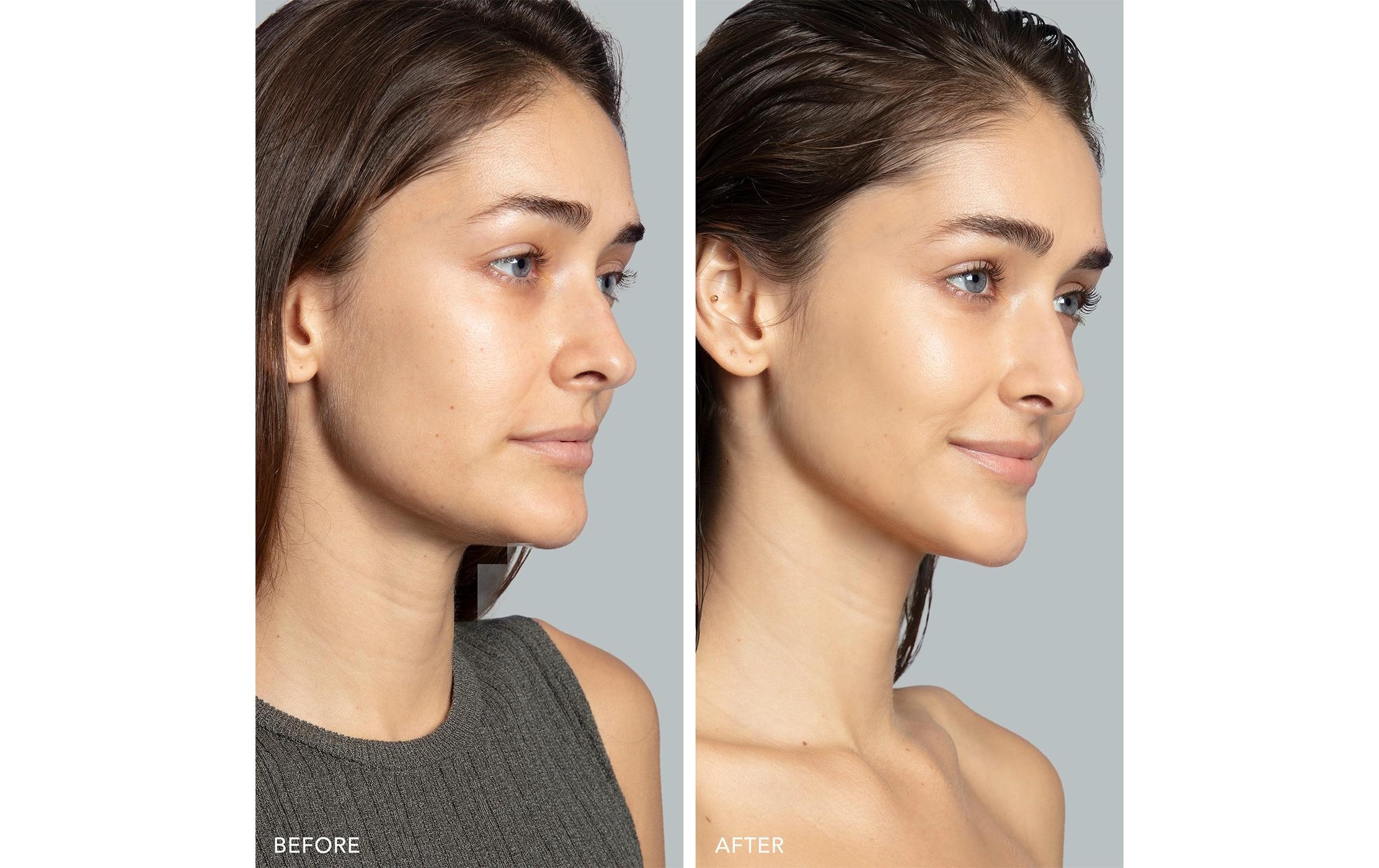 FOREO Anti-Aging-Gerät »BEAR™ 2«