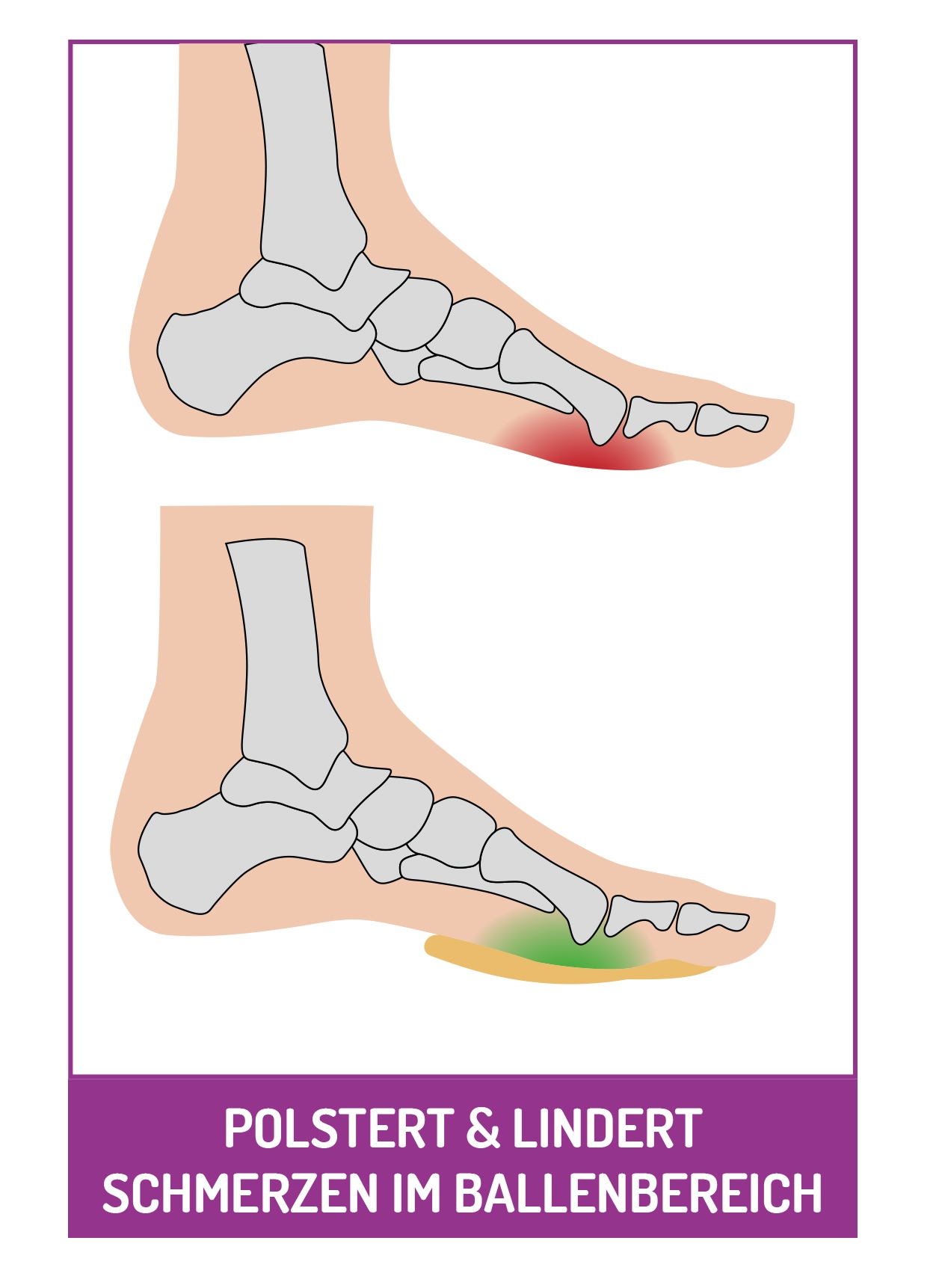 Fussgut Fussballenpolster »Vorfuss Ballenpolster Supersoft« Optimale Druckverteilung, Vorfusspolster, schützt vor Reibung und Druck