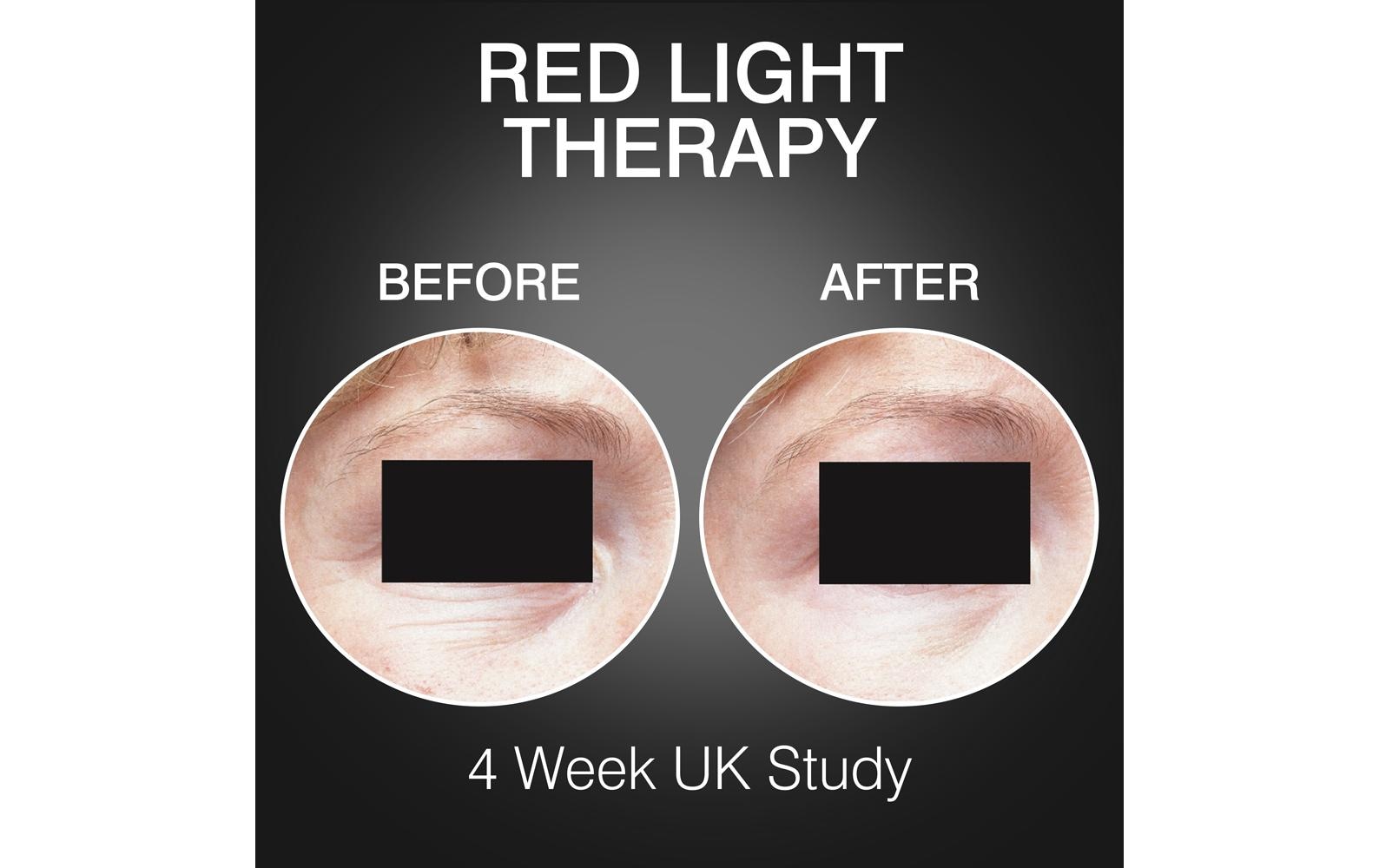 Rio Lichttherapiegerät »FaceGLO 1072 mit Serum«