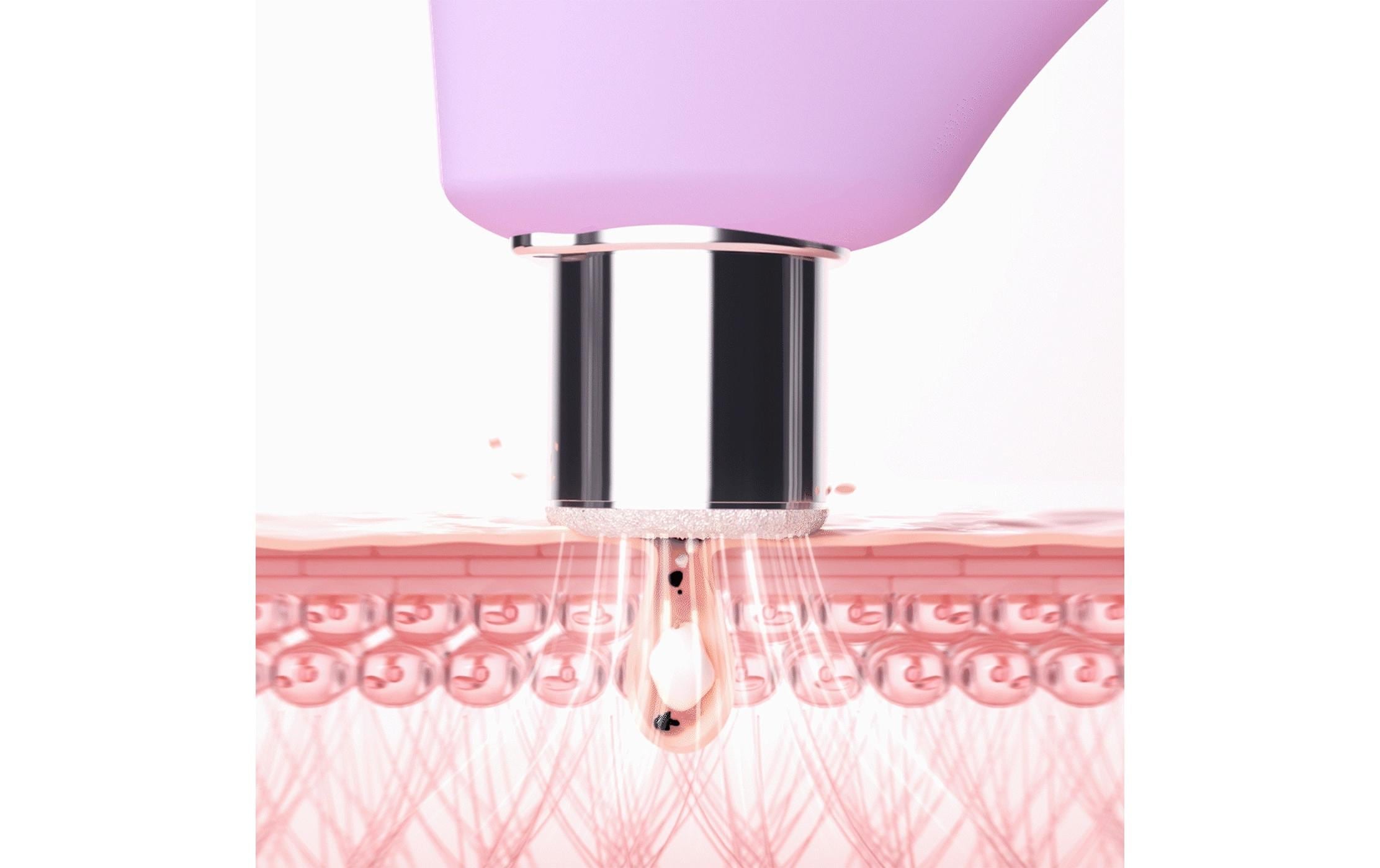 FOREO Porenreiniger »KIWI™ derma«