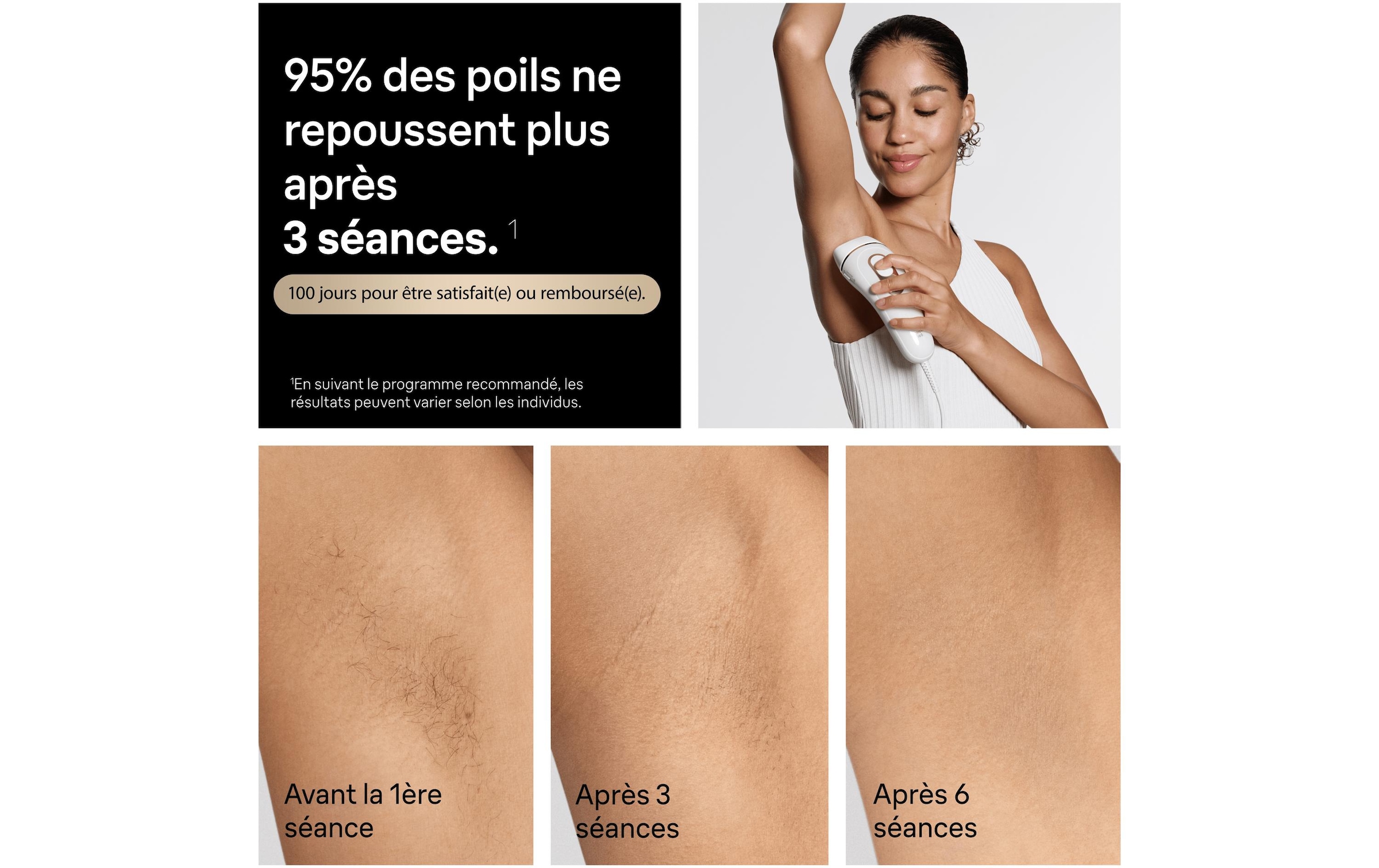Braun IPL-Haarentferner »Silk-expert Pro IPL PL5431« 400.000 Lichtimpulse dauerhafte Haarreduktion, mit Tasche, Venus Rasierer, 4 Aufsätze