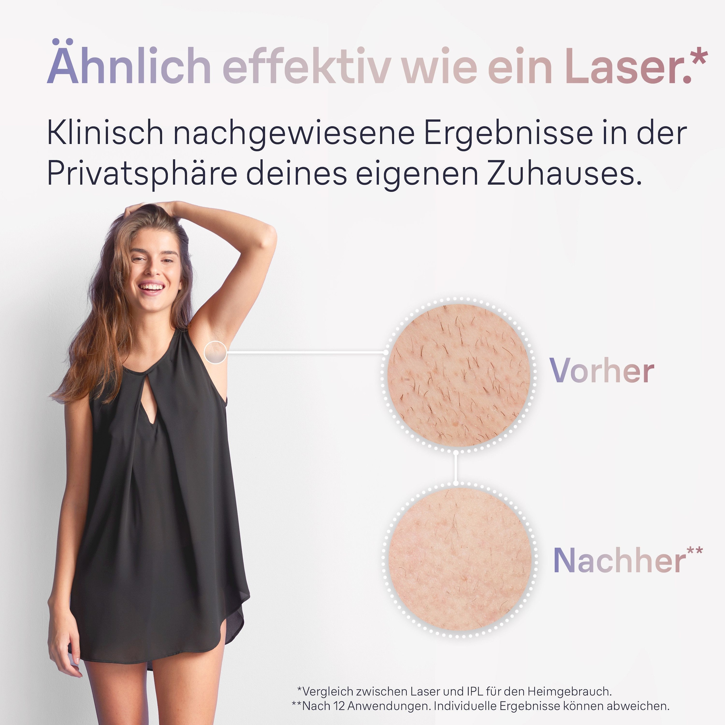 Braun IPL-Haarentferner »Smart Skin i·expert PL7249«, 3 Aufsätze für Gesicht & Körper, Venus Rasierer, Mini-Rasierer