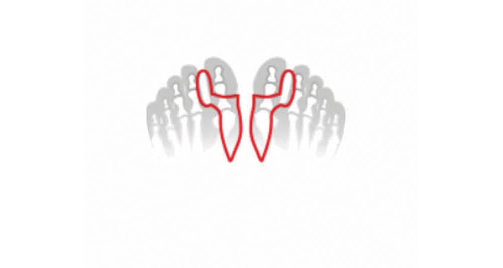 Fussgut Zehenkorrektor »Hallux Korrektor mit Ballensschutz, angenehm weich aus Softgel« hält die grosse Zehe auf Abstand, reduziert Reibung, mediz. Gel