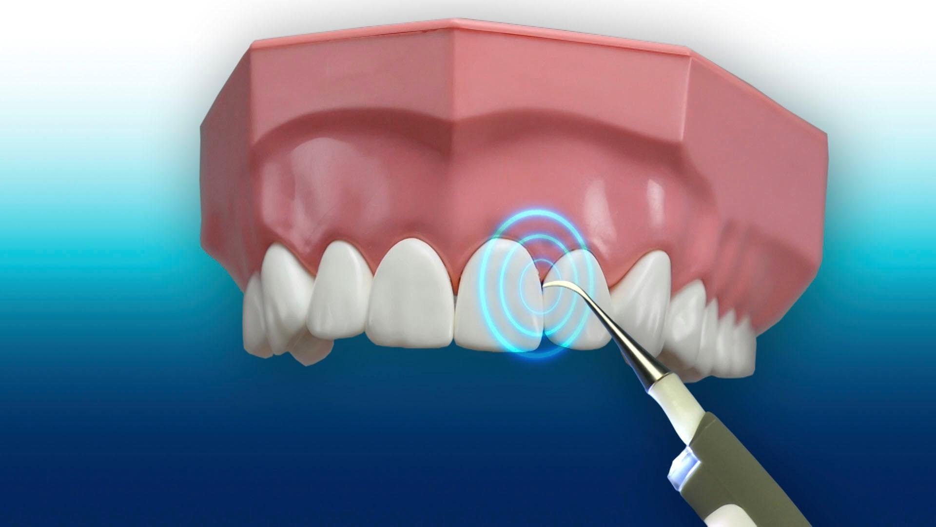 MediaShop Set d'hygiène dentaire »DentaPic Sonic« exklusives Set mit 2 zusätzlichen Aufsätzen