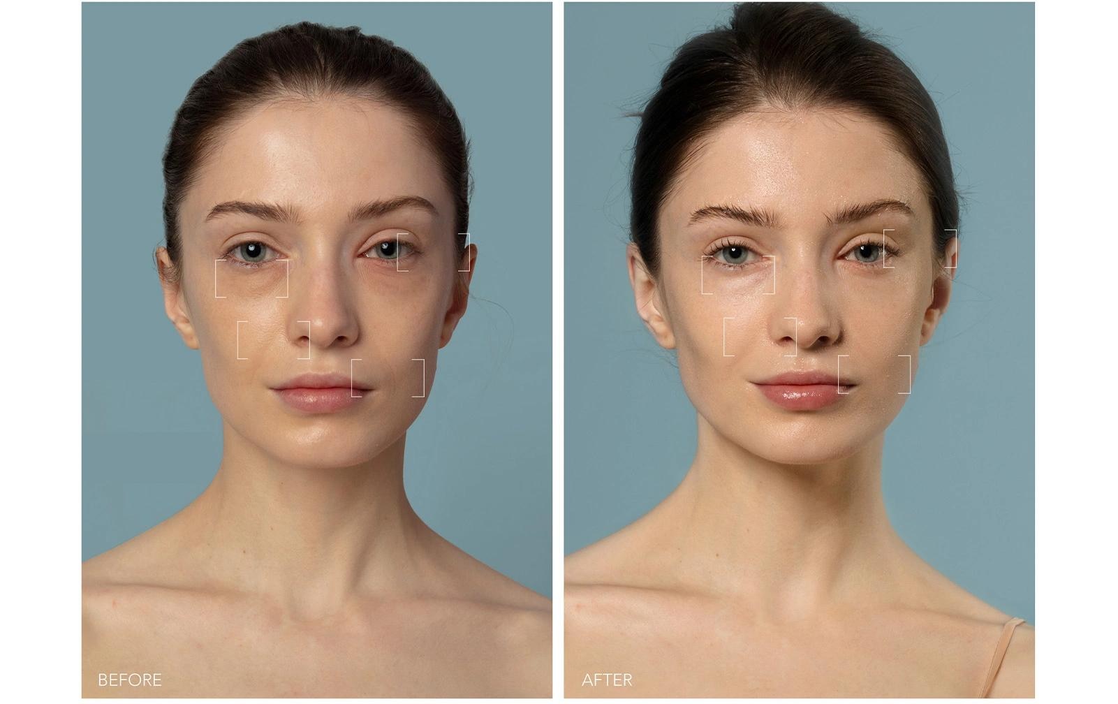 FOREO Anti-Aging-Gerät »UFO 3 Arktisches«